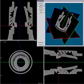 CT Scanning Services 3